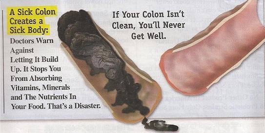 Expect During Colon Hydrotherapy