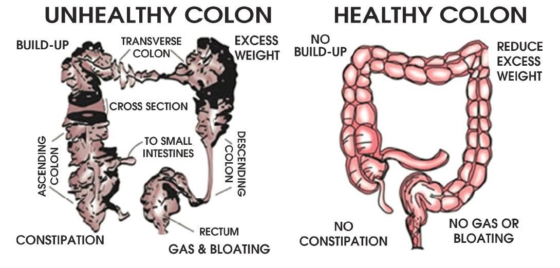 Equipo médico del sistema limpio de hidroterapia de colon
